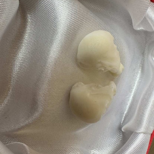  鱼宝