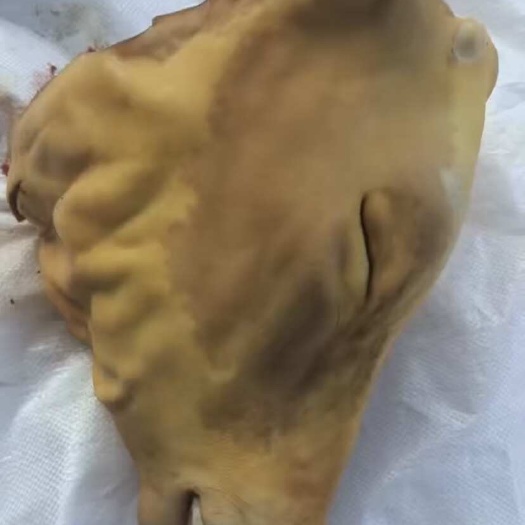 肃宁县牛头