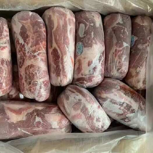 昆山市双汇颈背肌肉