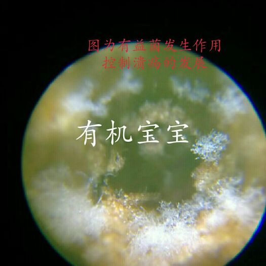 大新县 柑橘溃疡胶栋菌肥
