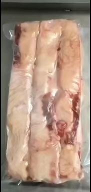 阳信县胸口油 