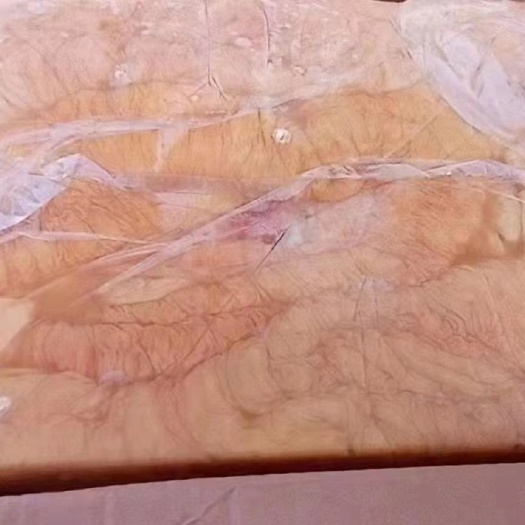郑州板肠