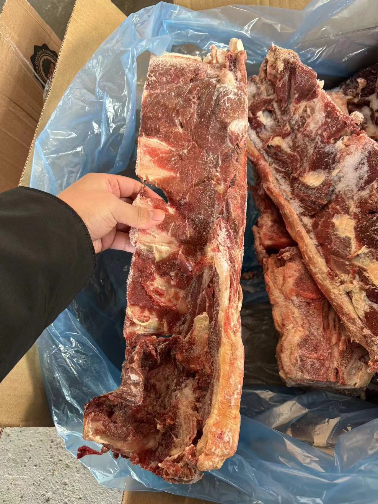 1930腰椎骨