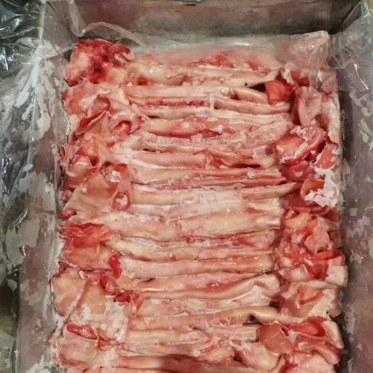 沂南县心管